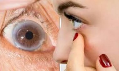 يظهر في صمت.. 6 علامات قد تكشف ارتفاع الكوليسترول في الجسم